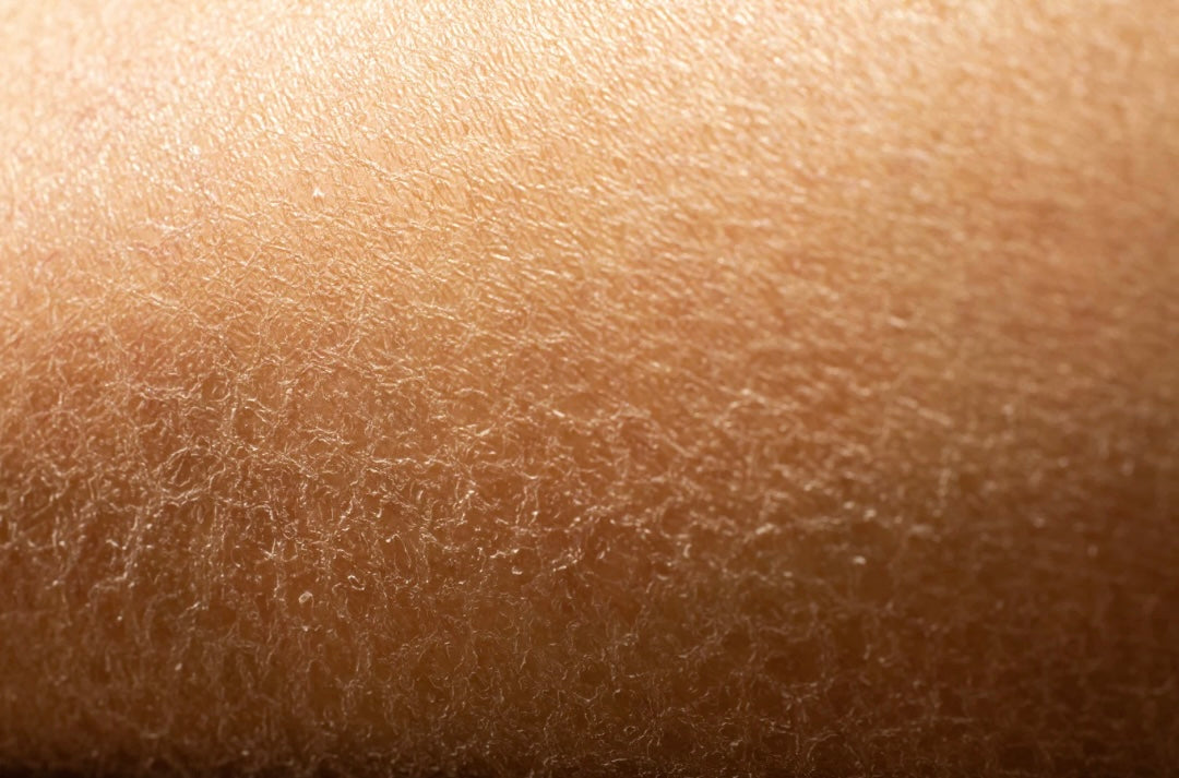 3 Reasons Your Dry Skin Keeps Coming Back—Your Routine Might Be Missing This Key Ingredient
